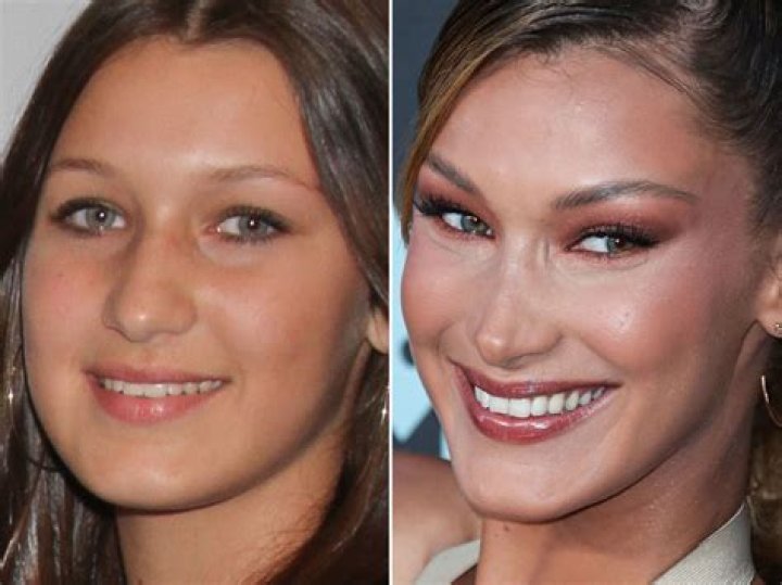 Bella Hadid Before After