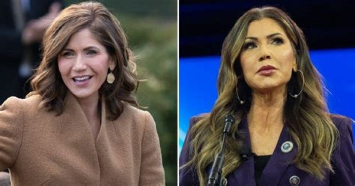 Discover The Secrets Behind Kristi Noem's Iconic Lips