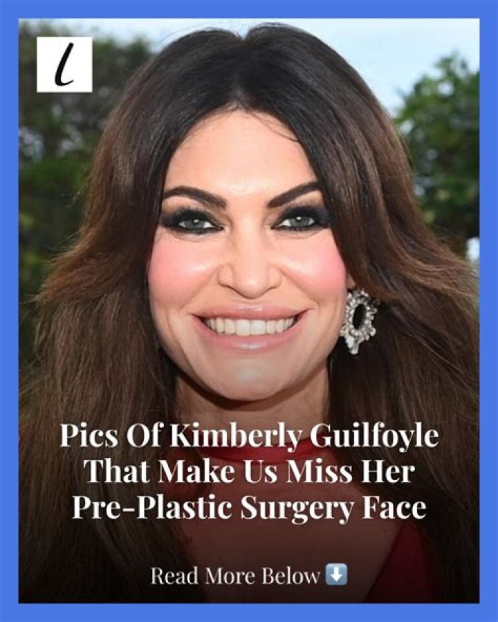 Kimberly Guilfoyle's Plastic Surgery Journey: A Comprehensive Guide