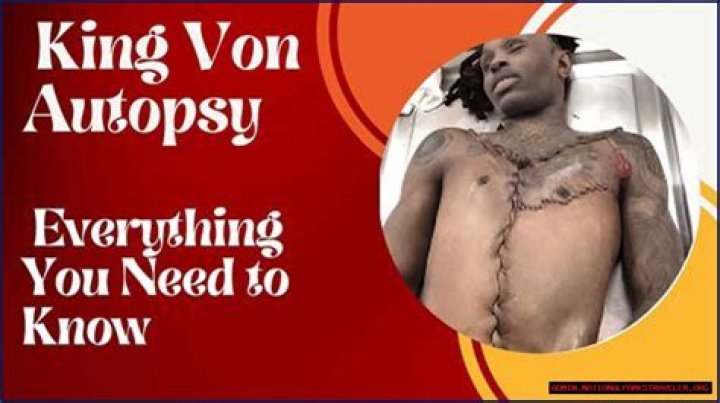 The Truth Behind King Von's Autopsy: Disturbing Details Revealed